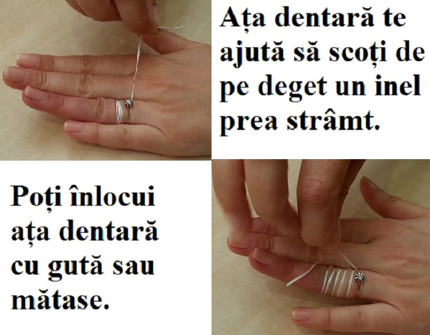 5 soluții rapide să scoți un inel pe deget Sfatulparintilor.ro