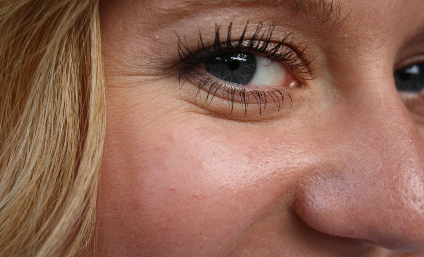 Riduri din jurul ochilor: Remedii naturiste eficiente