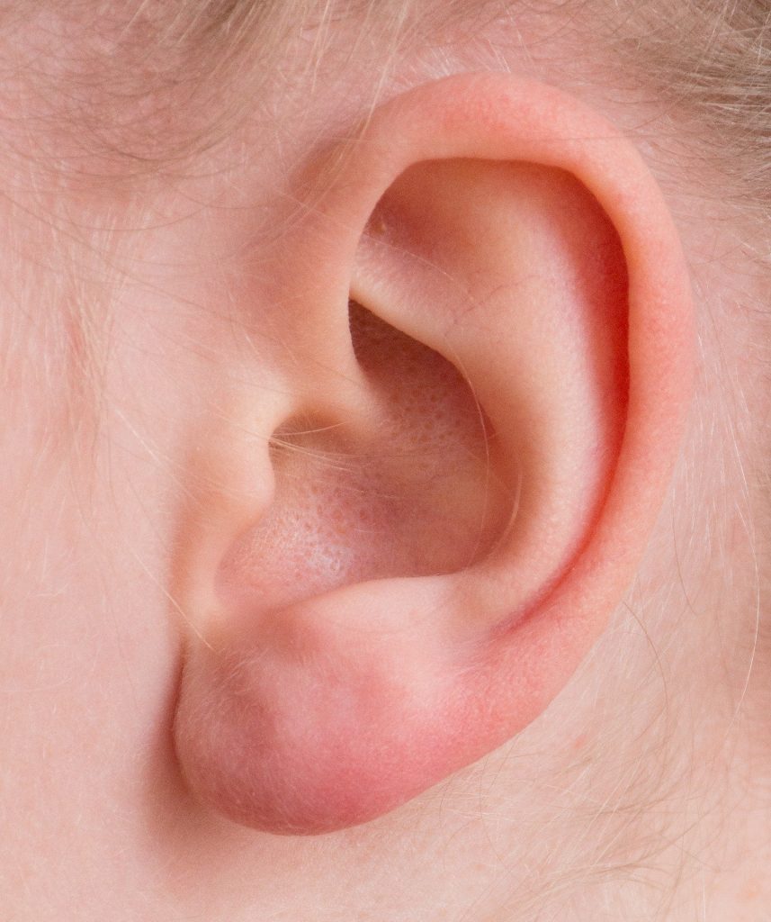 cel mai bun mod de a-ti curata urechile