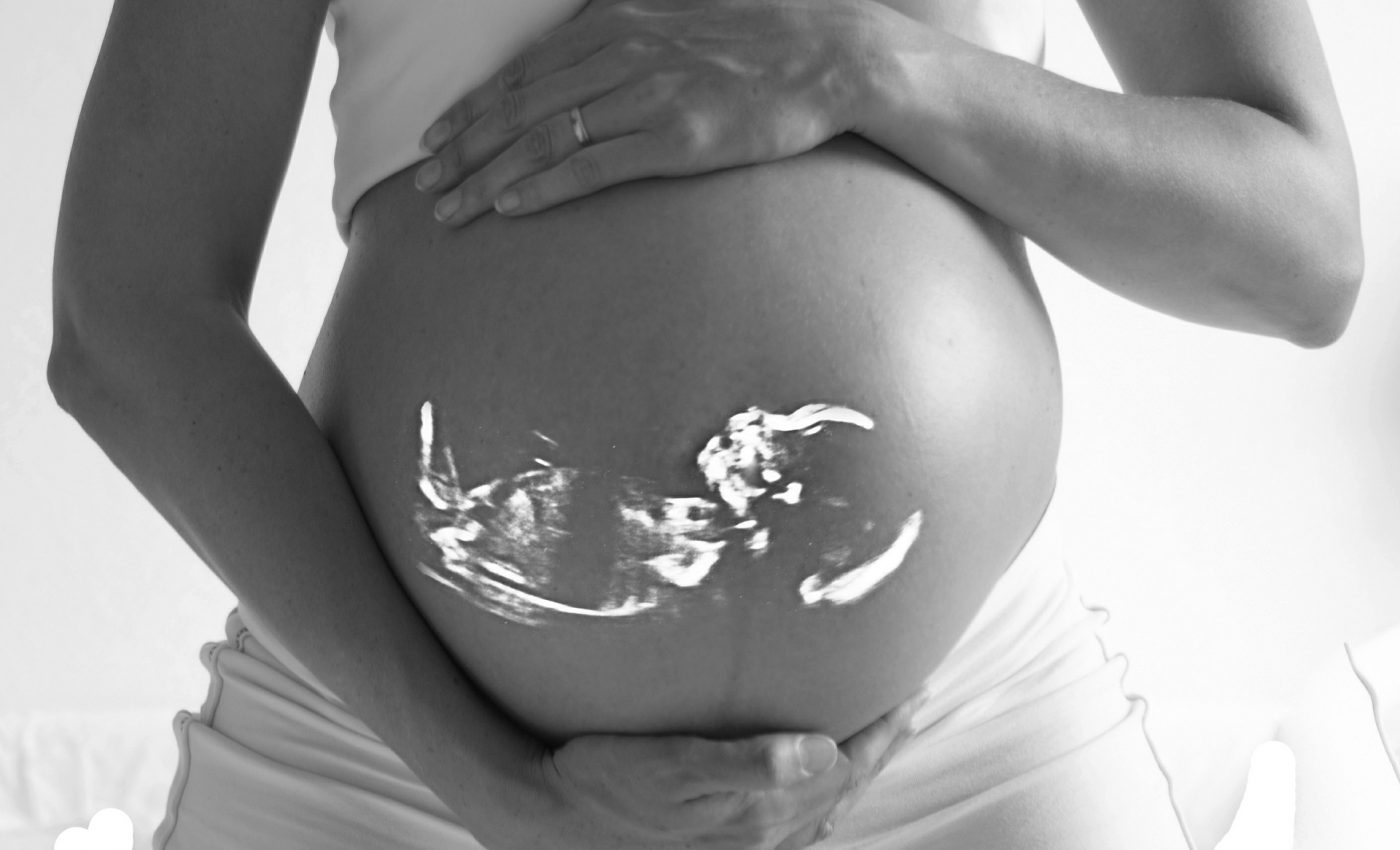 Ce inseamna daca copilul are cordonul ombilical in jurul gatului - sfatulparintilor.ro - pixabay_com - pregnant-518793_1920