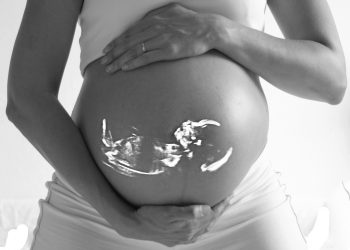 Ce inseamna daca copilul are cordonul ombilical in jurul gatului - sfatulparintilor.ro - pixabay_com - pregnant-518793_1920