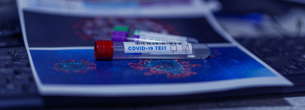 Ce nu trebuie sa mananci inainte de testul COVID - sfatulparintilor.ro - pixabay_com - covid-19-5057462_1920