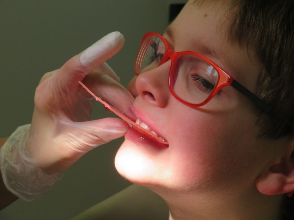 aparatul dentar la copii - sfatulparintilor.ro - pixagay_com - child-1933014_1920