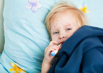 Rujeola revine în România