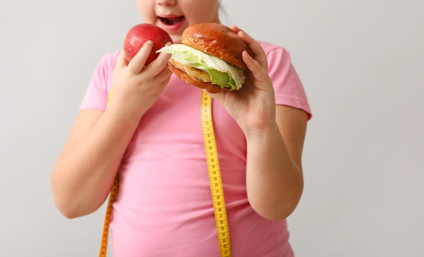 Obezitatea infantilă